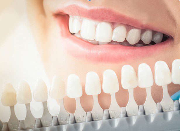 who benefits from cosmetic dentistry